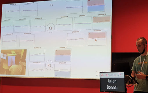 SOFMER IVS3 brain reaction